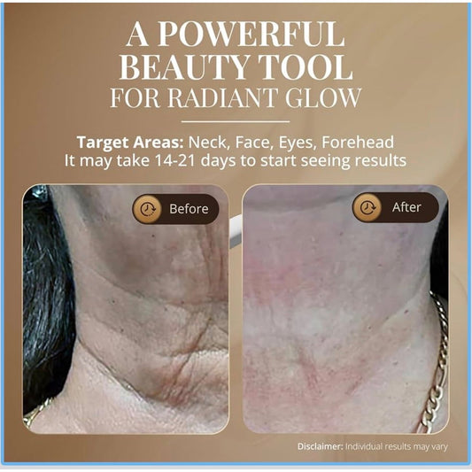 GLO24K Skin Rejuvenation Beauty Device