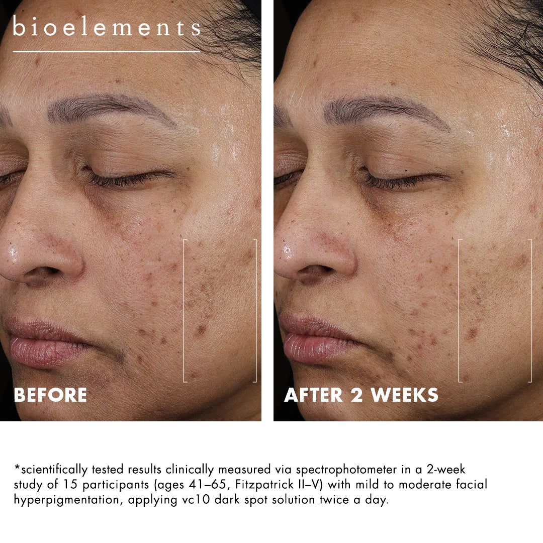 Bioelements vc10 dark spot solution