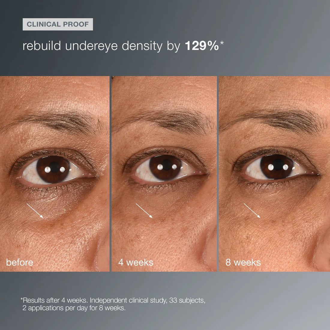 Dermalogica smart eye density 0.5